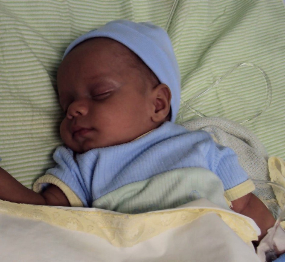 A newborn sleeping peacefully in a hospital in the Dominican Republic after his first gentle Atlas adjustment